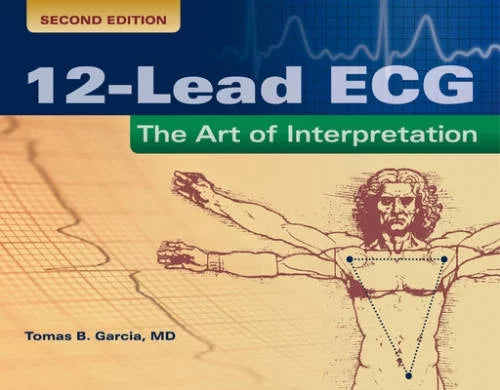 12-Lead Ecg Paperback G615